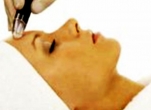 Microdermabrasion Treatment - 60 Minutes